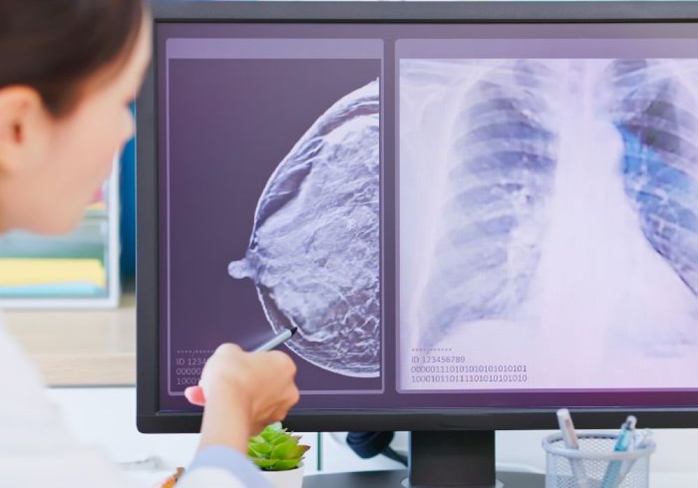 Comment faire face au diagnostic d’un cancer du sein