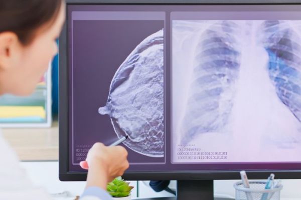 Comment faire face au diagnostic d’un cancer du sein