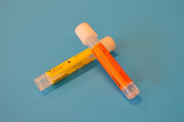 Comprendre la toxoplasmose : une infection parasitaire courante et souvent méconnue