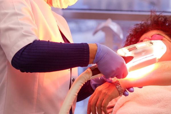 Épilation laser à Toulouse : une solution efficace et moderne
